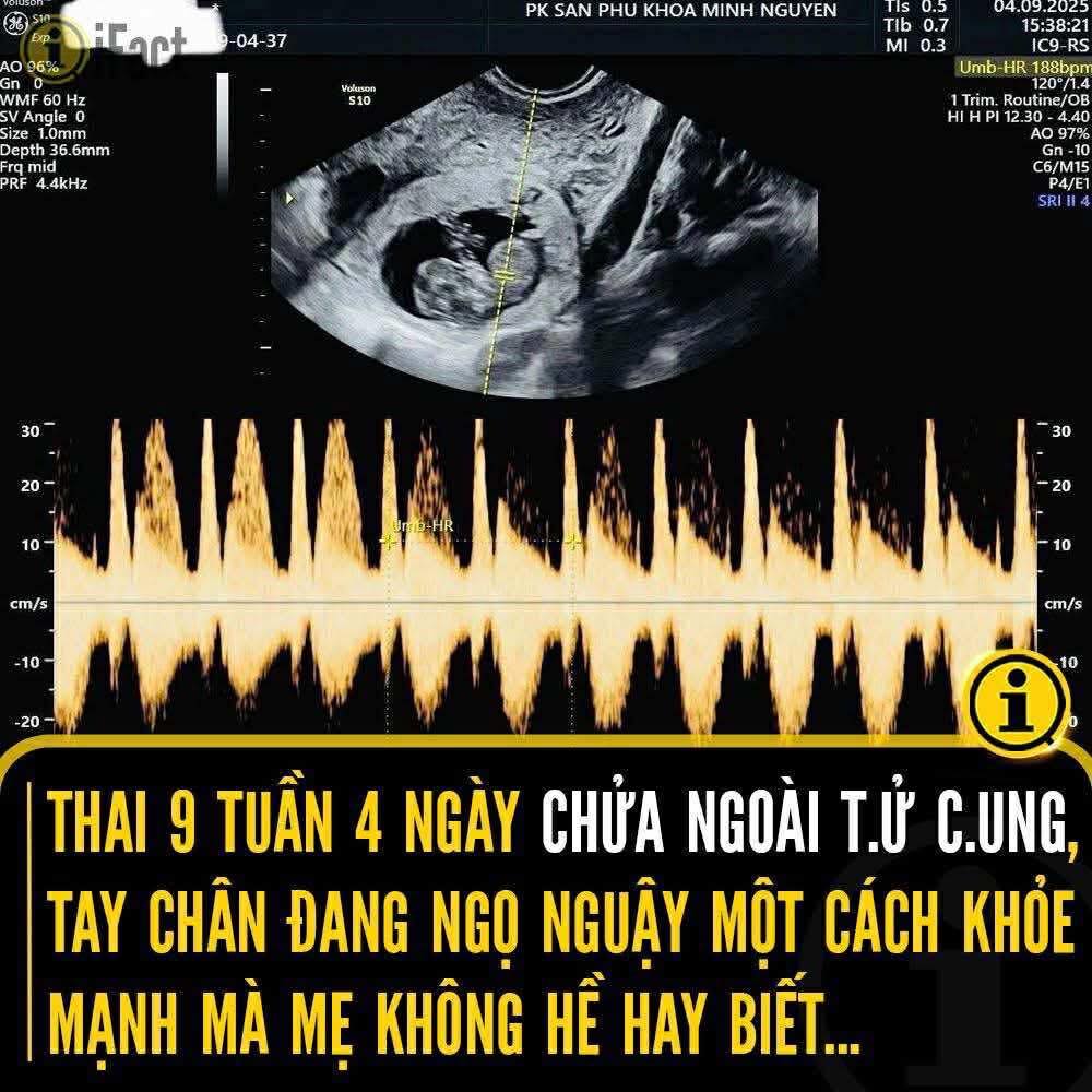 Cảnh báo: Khám thai sớm để bảo vệ sức khỏe mẹ và bé 2 545341321 1207500588082429 8344857890288737507 n