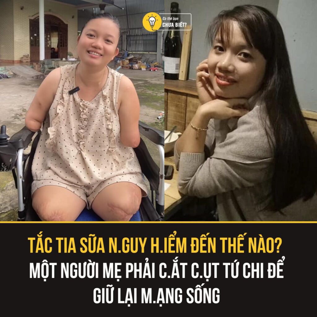 Nỗi Đau Từ Tắc Tia Sữa: Một Người Mẹ Cắt Cụt Tứ Chi Để Sống 2 548005230 1356077269520498 7013421445713365240 n