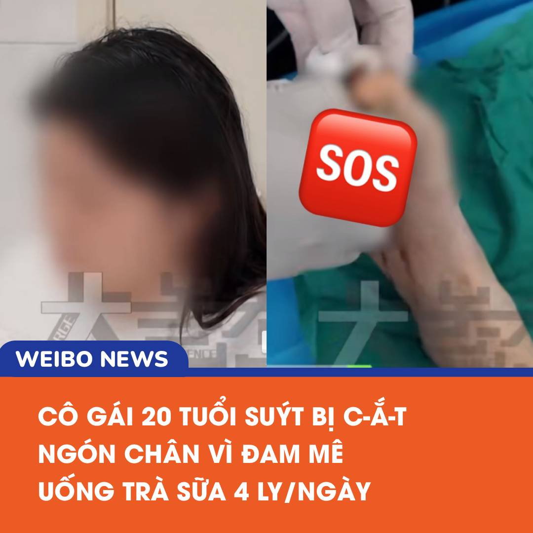 Cô gái 20 tuổi suýt mất ngón chân vì đam mê trà sữa 2 558293939 1204561651704543 1049688297441596272 n