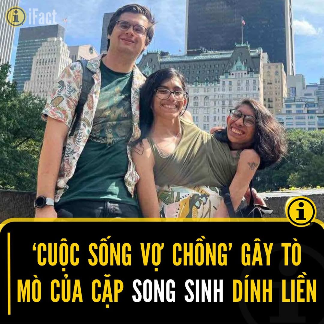 Cặp song sinh dính liền chia sẻ về tình yêu và cuộc sống 2 558810637 1231369965695491 3797222993075114113 n