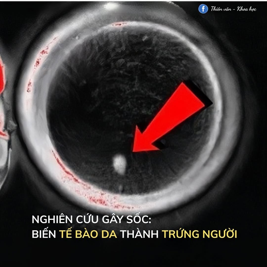Đột phá: Tạo trứng người từ tế bào da, bước ngoặt sinh sản mới 2 561502049 1202774281871840 4587909462274657140 n