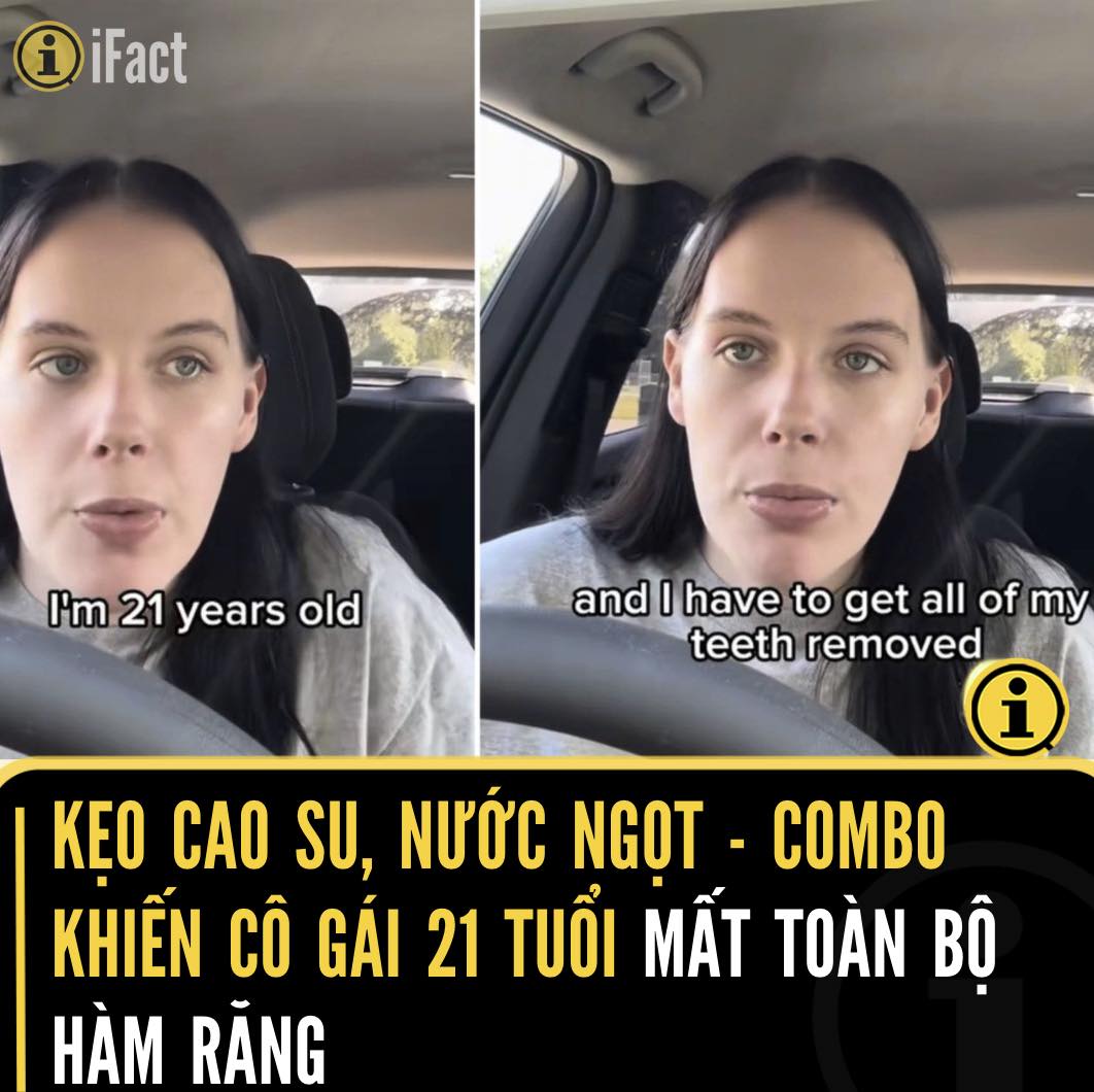 Cô gái 21 tuổi mất răng vì thói quen nhai kẹo cao su và uống nước ngọt 2 561805392 1234450535387434 5444983690146443217 n